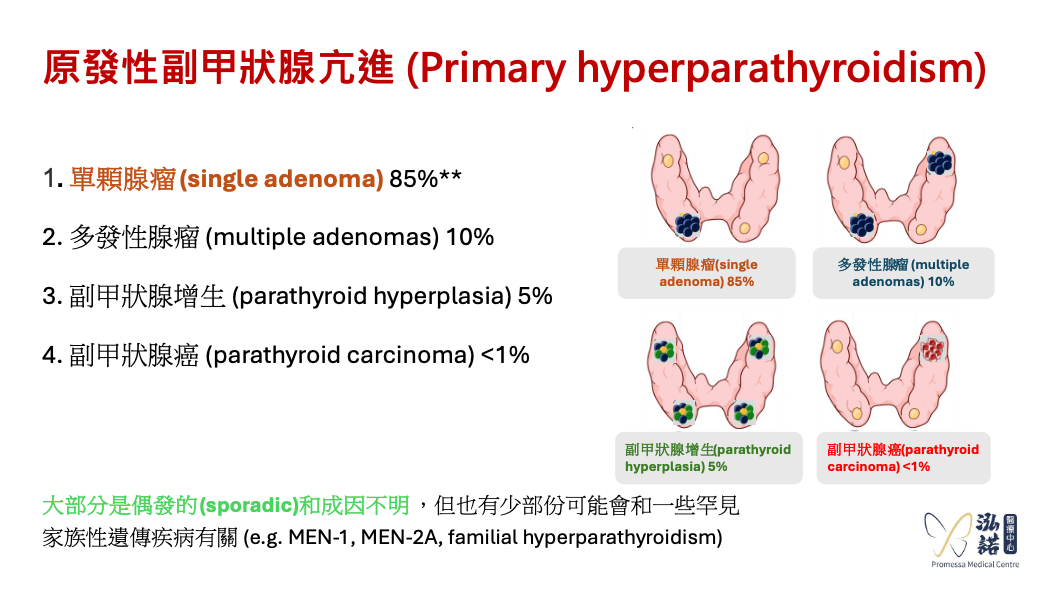 Primary Hyperparathyroidism