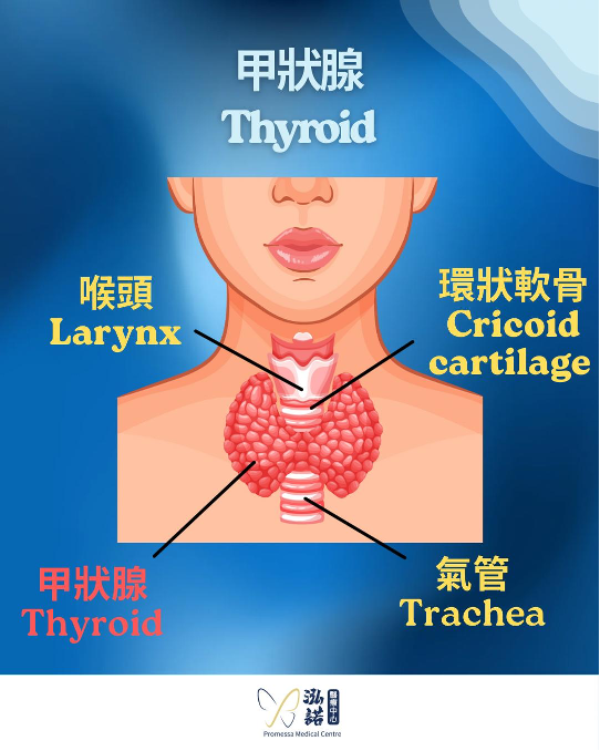 Thyroid Nodule