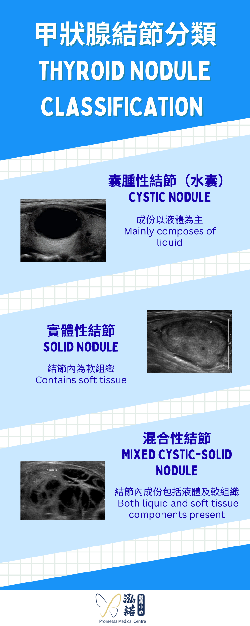 Thyroid Nodule Classification