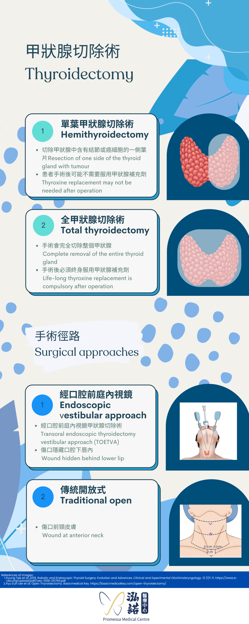 Thyroidectomy