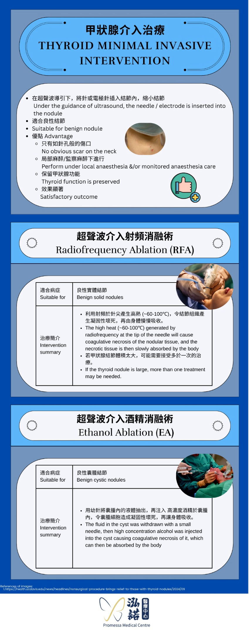 Thyroid Minimal Invasive Intervention